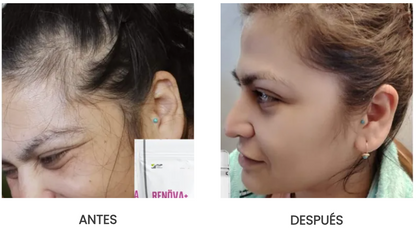 ✨ Colágeno RENÖVA+ — Tu dosis diaria de juventud y vitalidad ✨