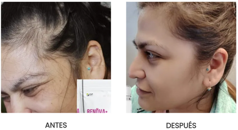 ✨ Colágeno RENÖVA+ — Tu dosis diaria de juventud y vitalidad ✨