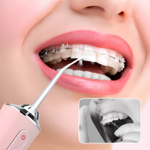 Irrigador Portátil 4 En 1 HidroDent | Sonrisa Perfecta Sin Dolor Ni Interrupciones Y En Tiempo Récord😁