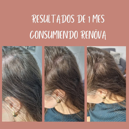 ✨ Colágeno RENÖVA+ — Tu dosis diaria de juventud y vitalidad ✨