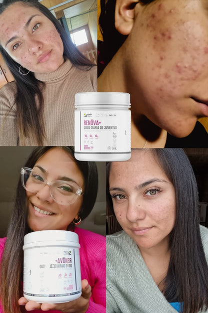 ✨ Colágeno RENÖVA+ — Tu dosis diaria de juventud y vitalidad ✨