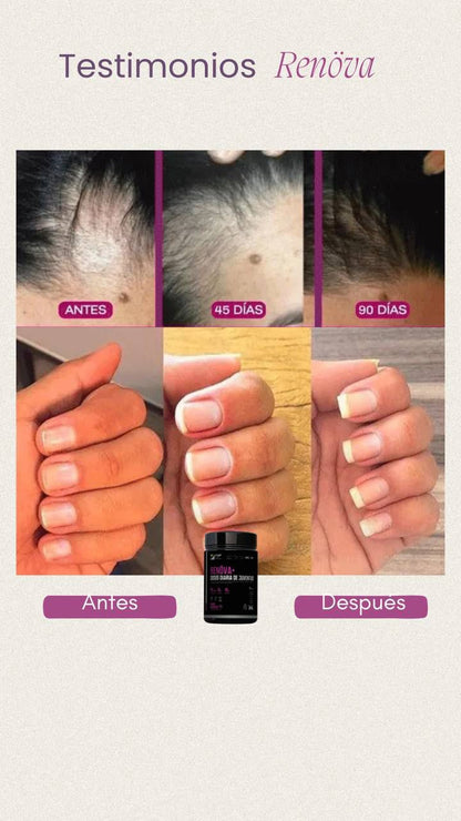 ✨ Colágeno RENÖVA+ — Tu dosis diaria de juventud y vitalidad ✨