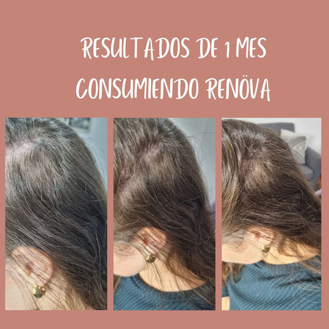 ✨ Colágeno RENÖVA+ — Tu dosis diaria de juventud y vitalidad ✨