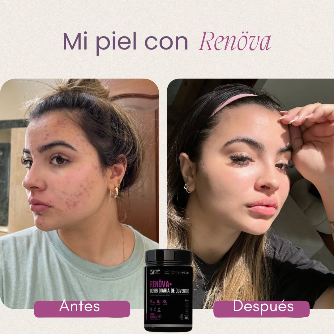 ✨ Colágeno RENÖVA+ — Tu dosis diaria de juventud y vitalidad ✨