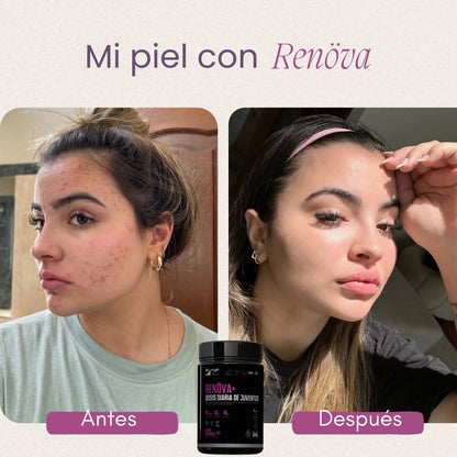 ✨ Colágeno RENÖVA+ — Tu dosis diaria de juventud y vitalidad ✨