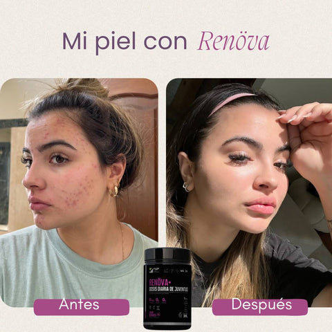 ✨ Colágeno RENÖVA+ — Tu dosis diaria de juventud y vitalidad ✨