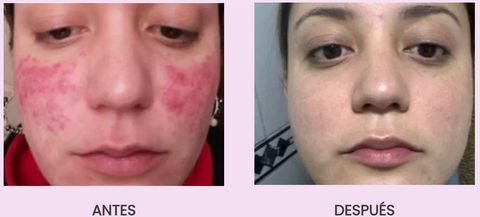 ✨ Colágeno RENÖVA+ — Tu dosis diaria de juventud y vitalidad ✨